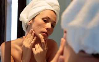 Как избавиться от прыща за одну ночь? Проверенные методы для всех
