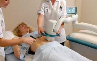 Liposonix (Липосоникс) – избавляемся от жира за один сеанс