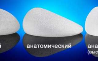 Круглые против анатомических: выбираем имплантаты для идеальной формы груди