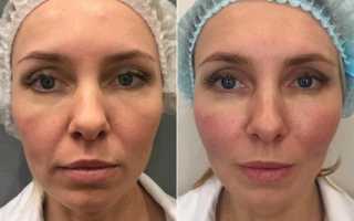 Тюнинг full-face: как это на самом деле и что входит